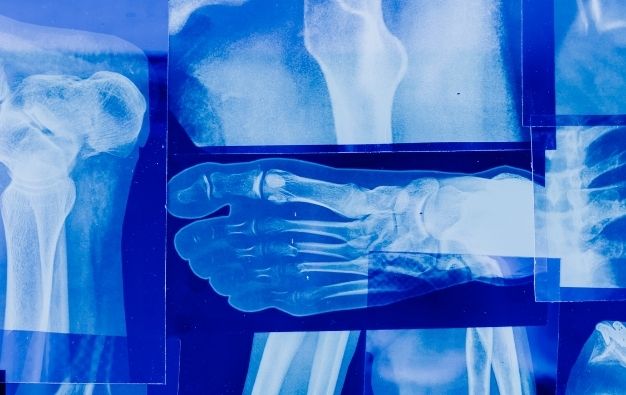 La radiografia digitale: l'importanza di ottenere immagini accurate per le diagnosi dei - CMR Borgomanero