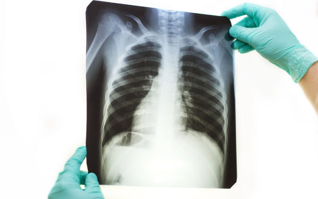 Radiografia: quando farla e quali malattie possono essere diagnosticate con un esame radiologico