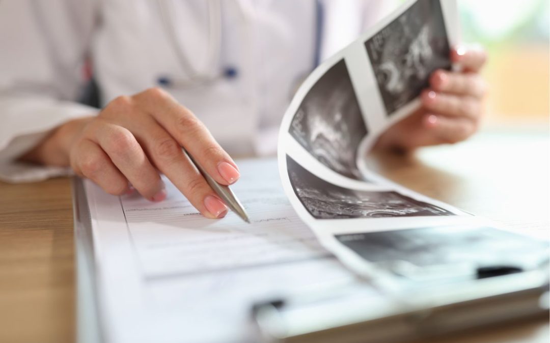 Adenomiosi uterina, cos’è e diagnosticarla